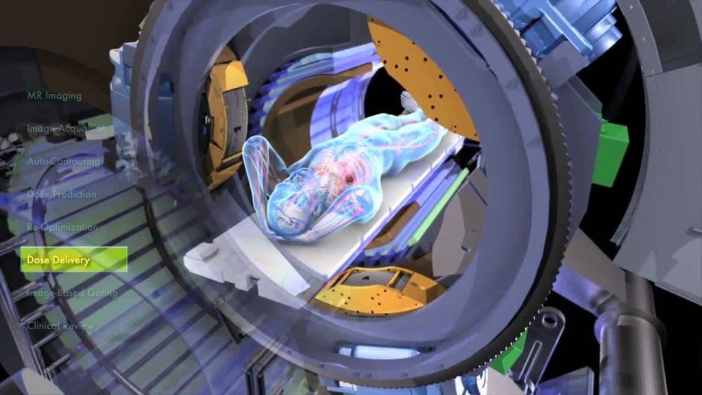 View Ray Cancer treatment device at Shk Khalifa Hospital RAK